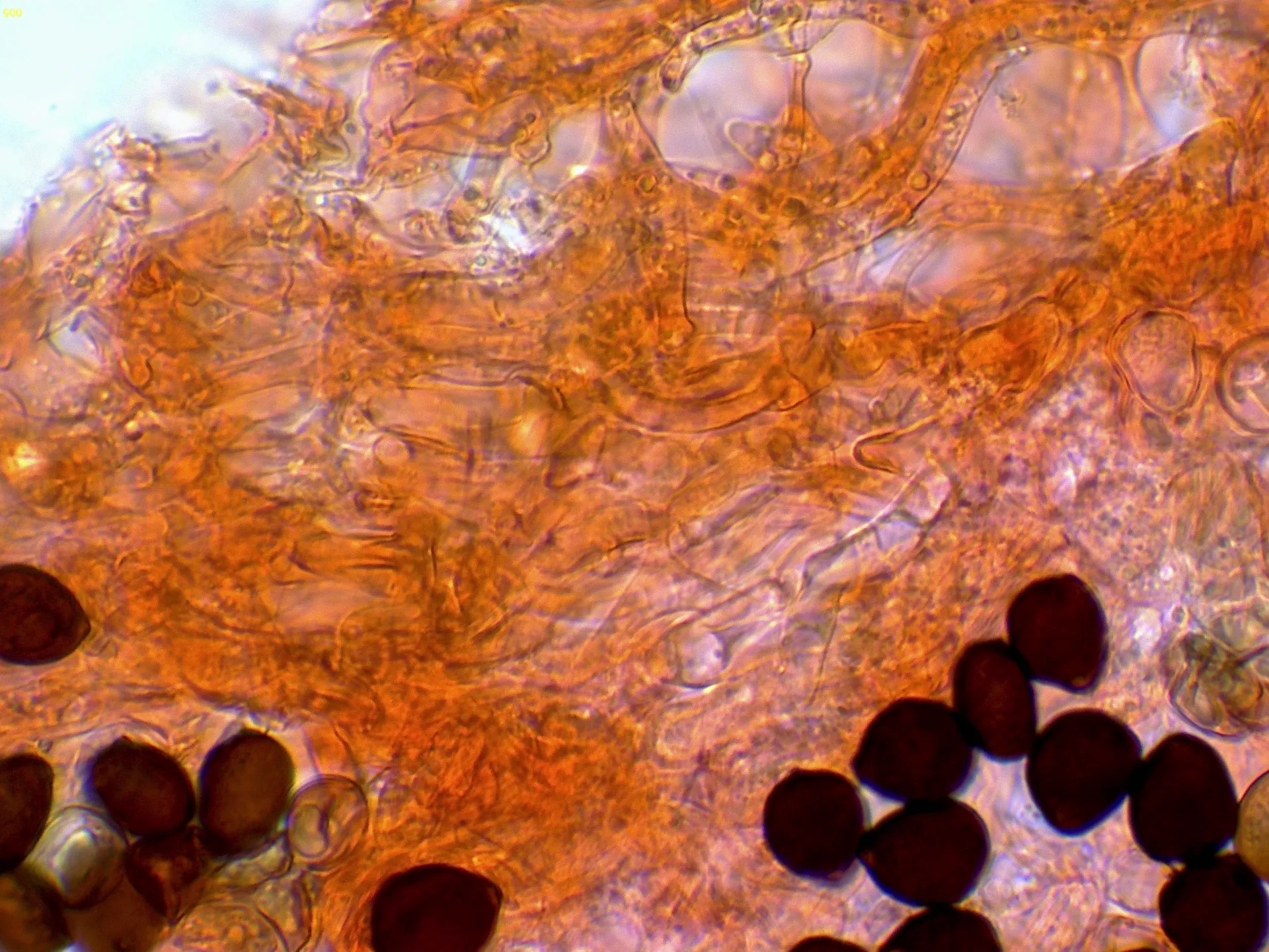 Microscopía de Parasola hercules - 11 - Subpellis-005